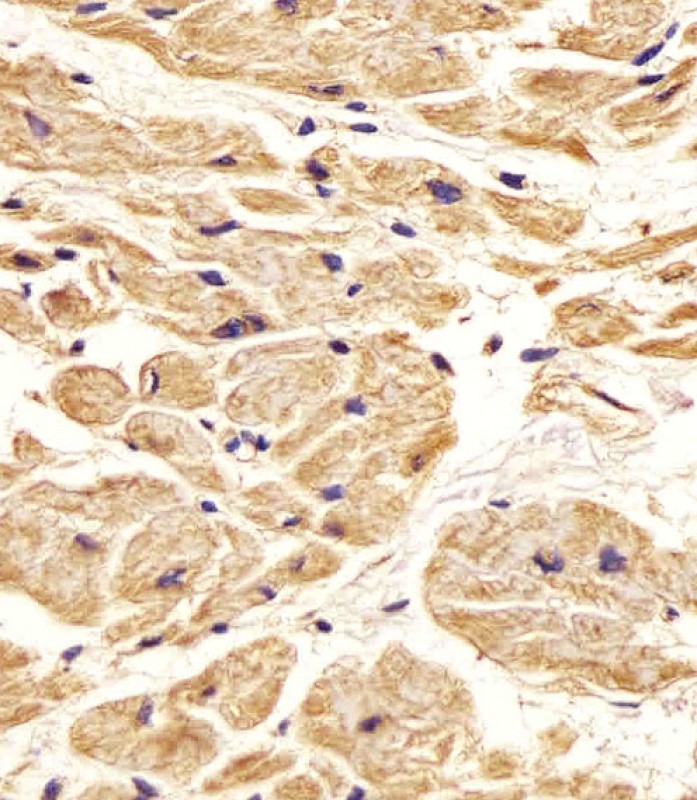 Rabbit anti-Nestin Polyclonal Antibody(S1409)