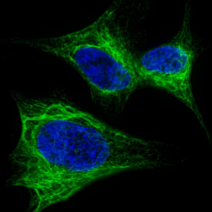 Rabbit anti-Nestin Polyclonal Antibody(S1409)