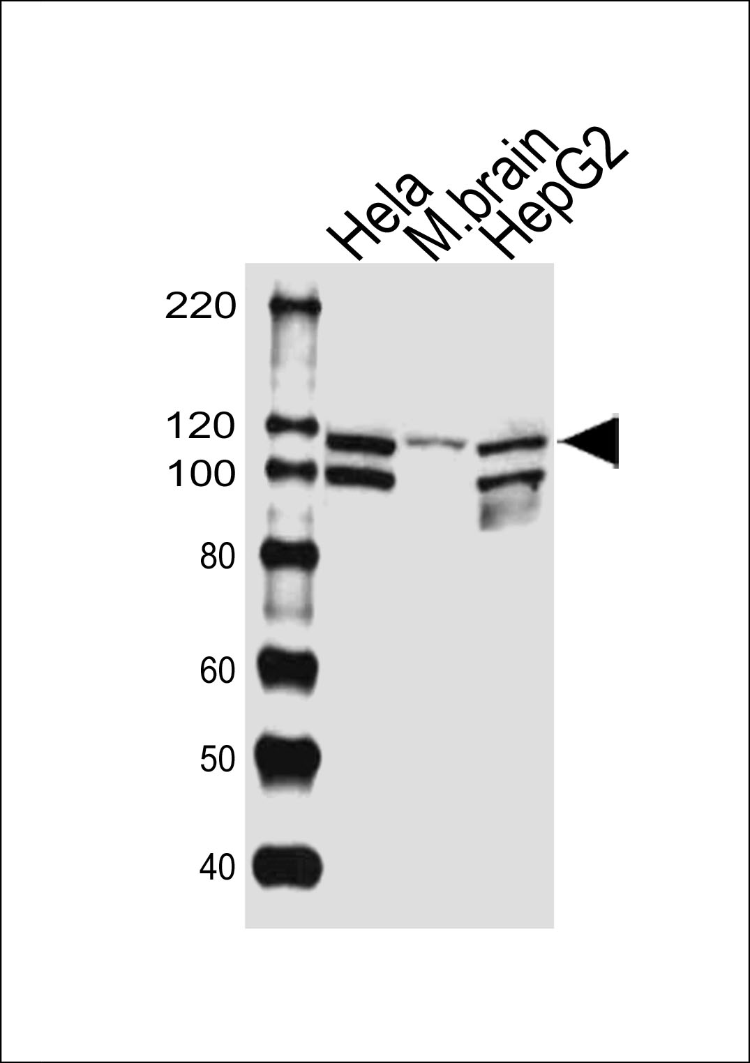 Rabbit anti-UBE3C Polyclonal Antibody(Center)