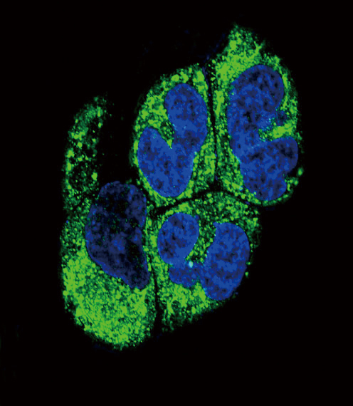 Rabbit anti-AGTR1 Polyclonal Antibody(Center)