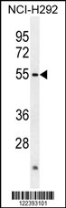 Rabbit anti-ACTL7A Polyclonal Antibody(N-term)