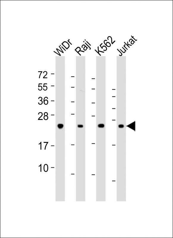 Rabbit anti-CTLA4 Polyclonal Antibody(N-term)