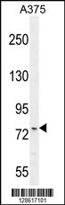 Rabbit anti-ANR44 Polyclonal Antibody(Center)