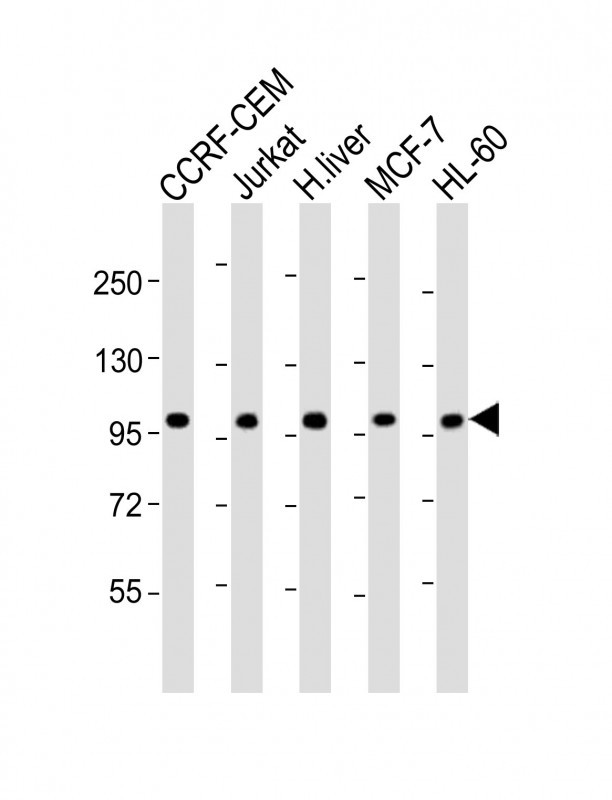 Rabbit anti-RSBN1 Polyclonal Antibody(N-term)