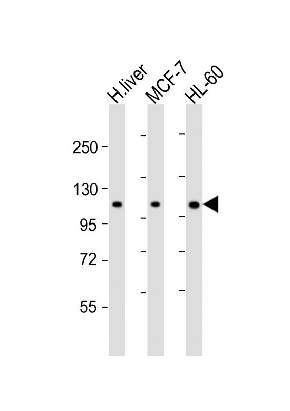 Rabbit anti-RSBN1 Polyclonal Antibody(N-term)