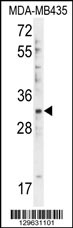 Rabbit anti-DTWD1 Polyclonal Antibody(Center)