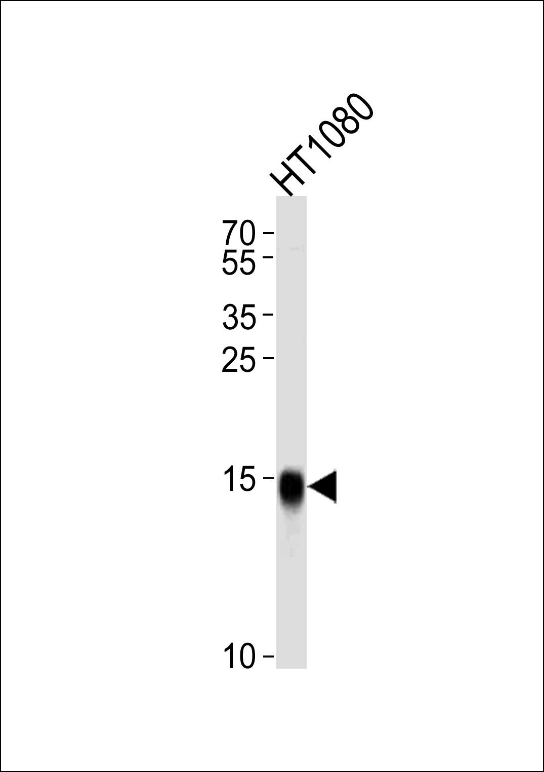 Rabbit anti-IFITM3 Polyclonal Antibody(N-term)