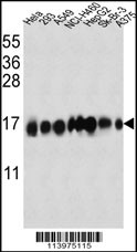 Rabbit anti-IFITM3 Polyclonal Antibody(N-term)