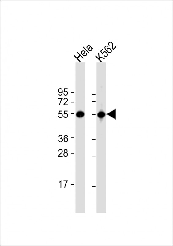 Rabbit anti-ATP6V1B1 Polyclonal Antibody(Center)