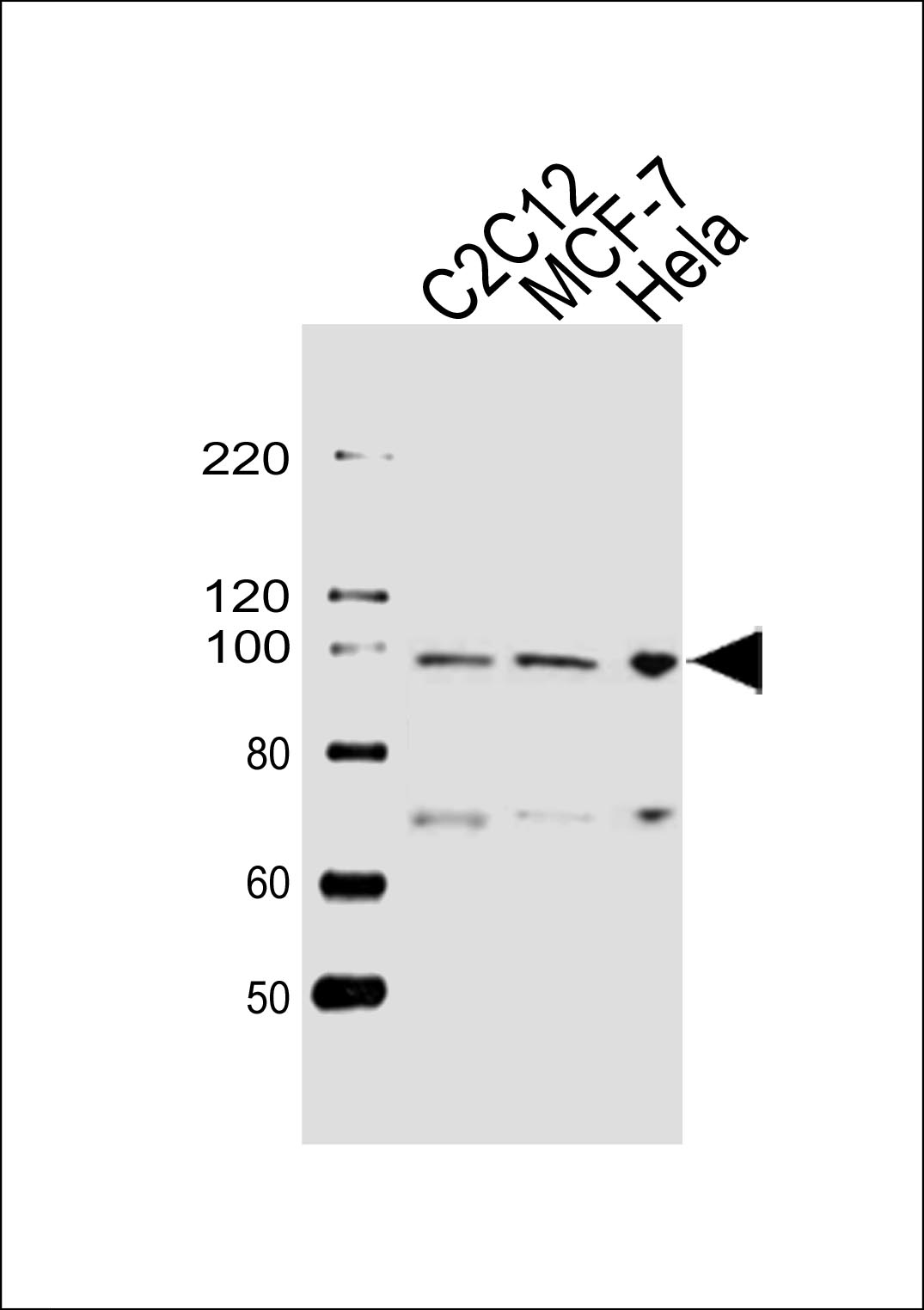 Rabbit anti-HSP90B1 Polyclonal Antibody(Center)