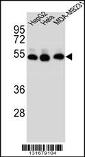 Rabbit anti-TUBB2B Polyclonal Antibody(N-term)