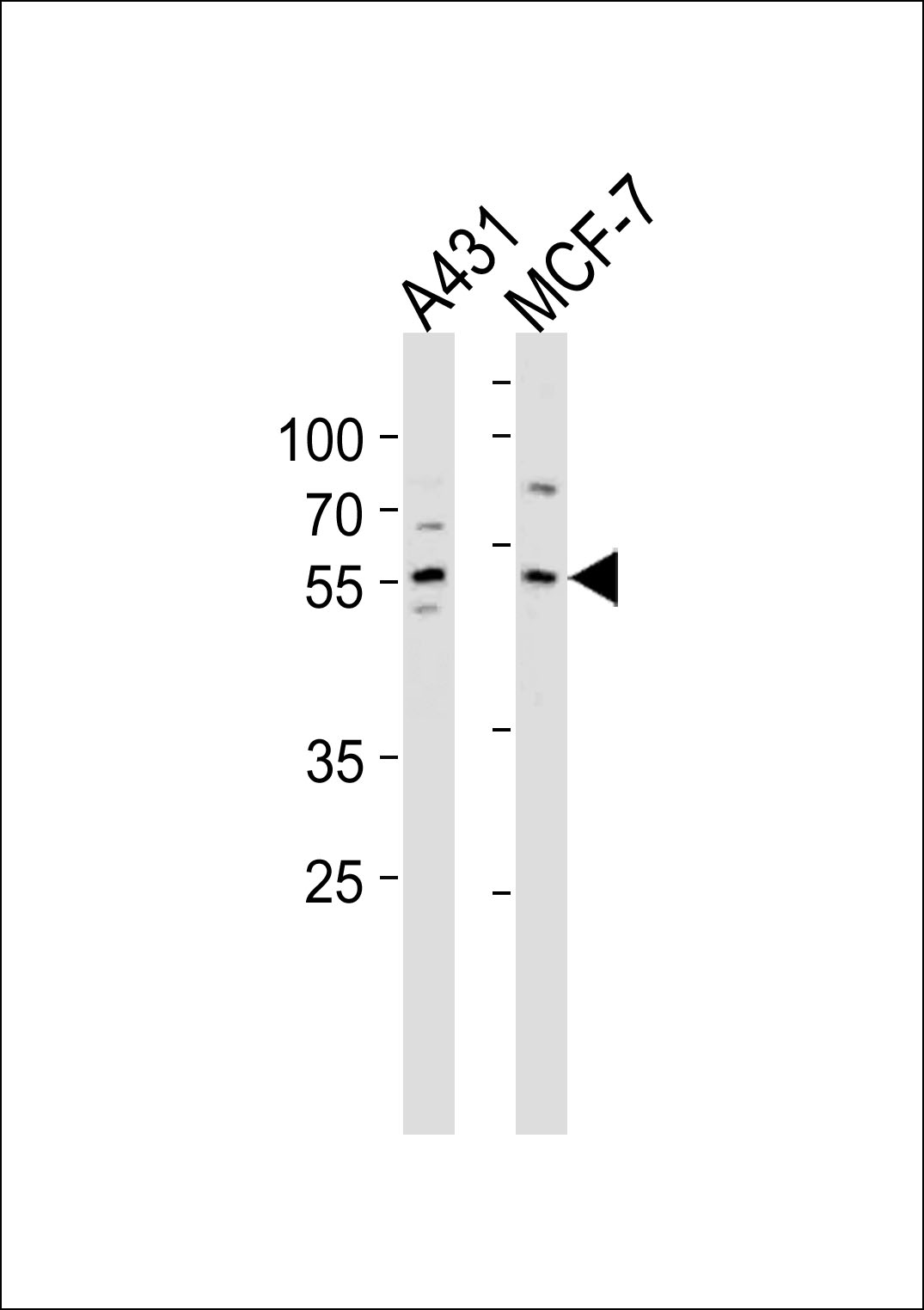 Rabbit anti-KLF4 Polyclonal Antibody(C-term)