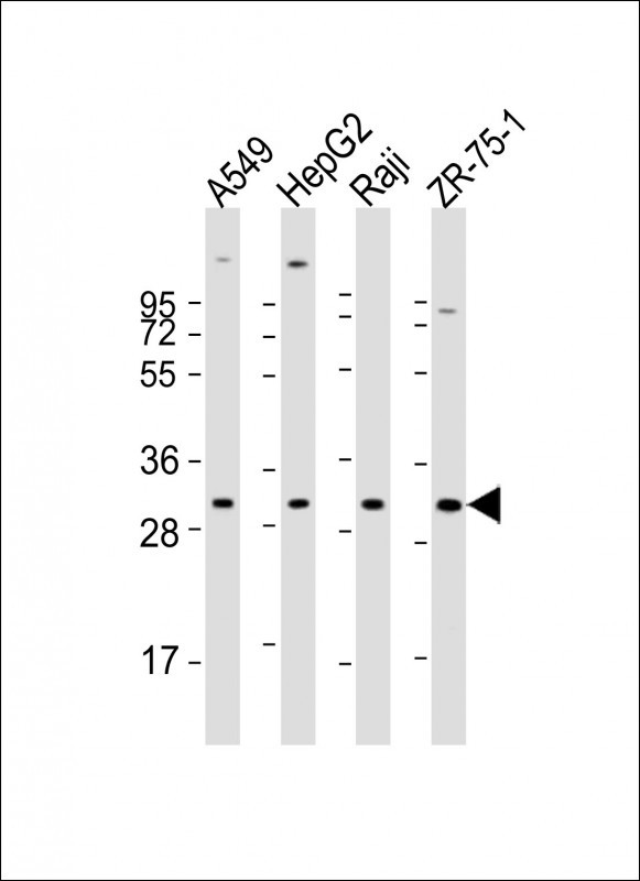 Rabbit anti-PDCD1LG2 Polyclonal Antibody(N-term)