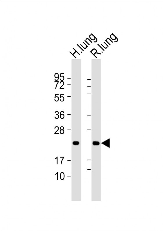 Rabbit anti-SFTPC Polyclonal Antibody(N-term)
