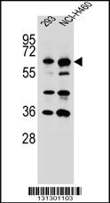 Rabbit anti-CKAP4 Polyclonal Antibody(C-term)