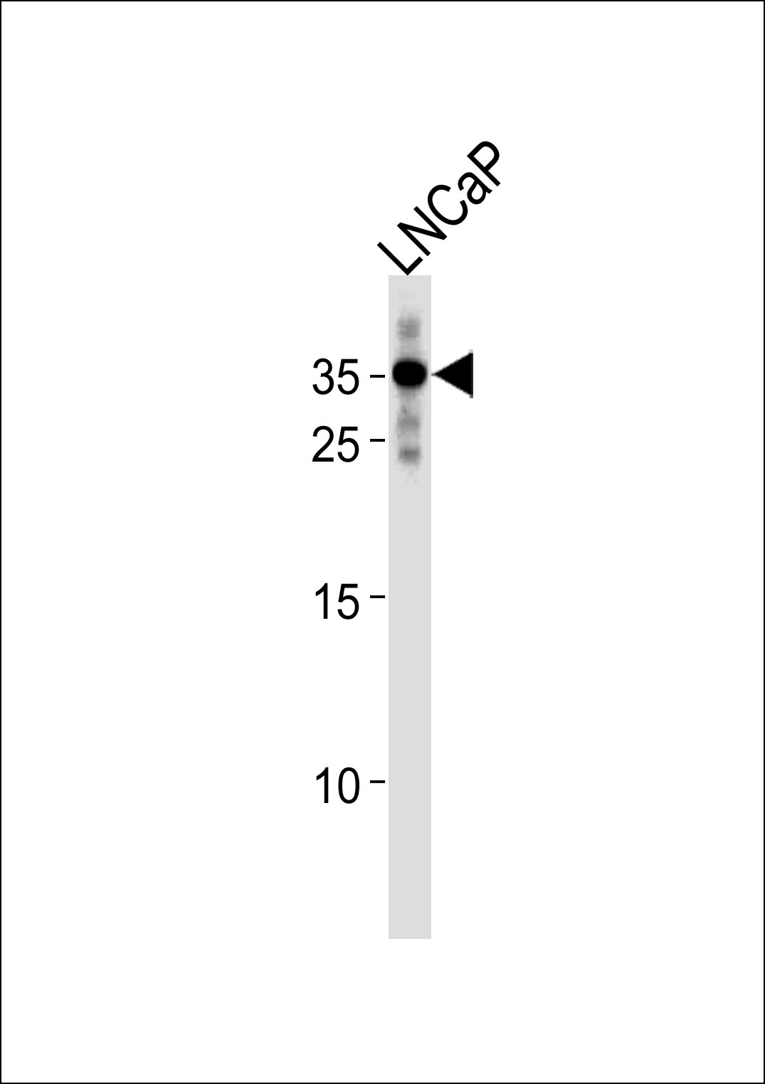 Rabbit anti-RNF4 Polyclonal Antibody(C-term)