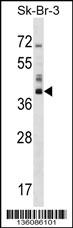 Rabbit anti-HSD17B1 Polyclonal Antibody(C-term)