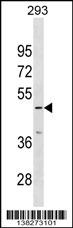 Rabbit anti-IP6K3 Polyclonal Antibody(N-term)