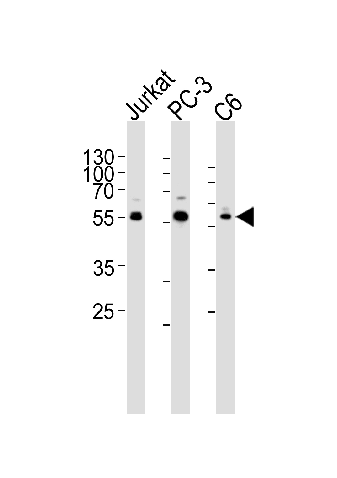 Rabbit anti-AKT1/2/3 Polyclonal Antibody(Center)