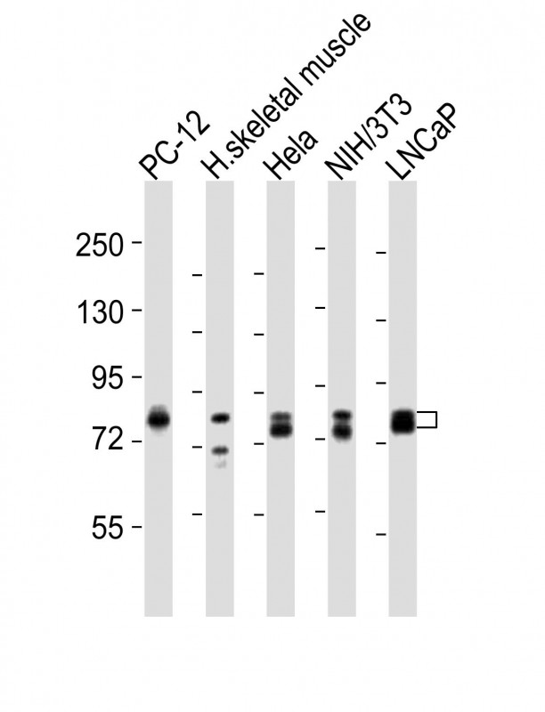Rabbit anti-DNM1L Polyclonal Antibody(C-term)