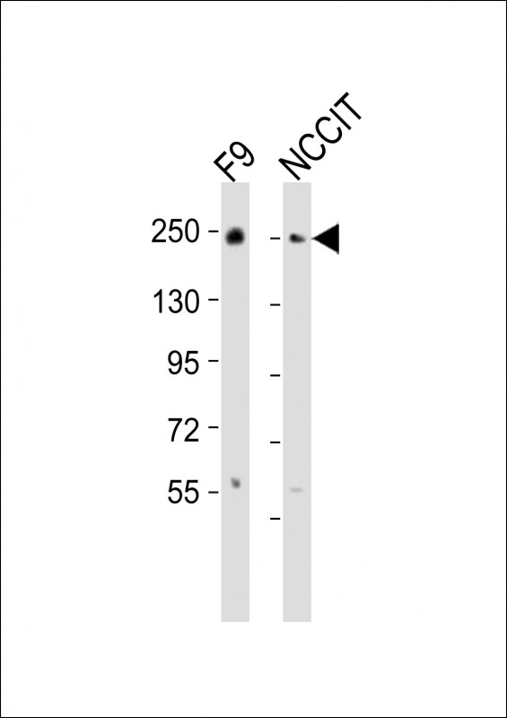 Rabbit anti-PBRM1 Polyclonal Antibody(C-term)
