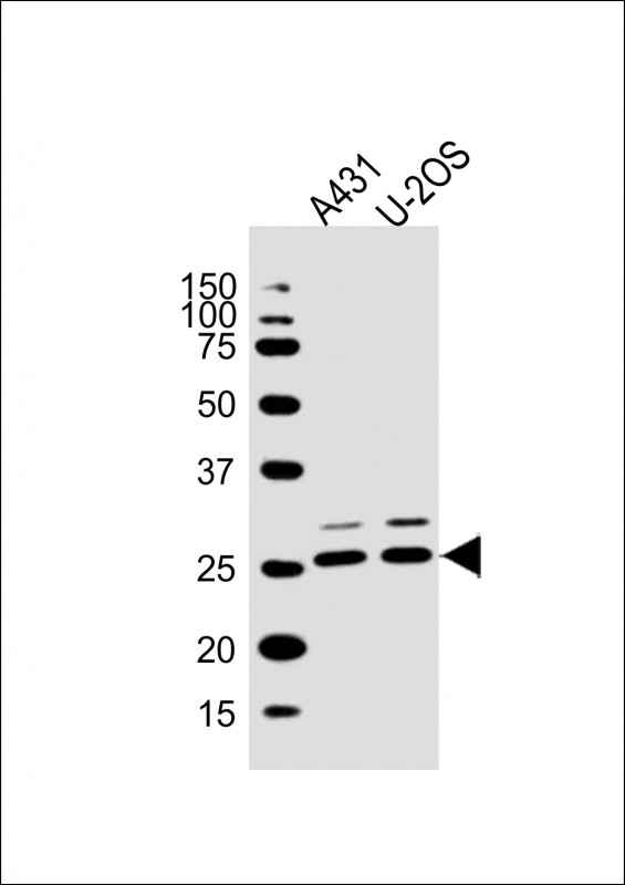 Rabbit anti-MLF1 Polyclonal Antibody(C-term)