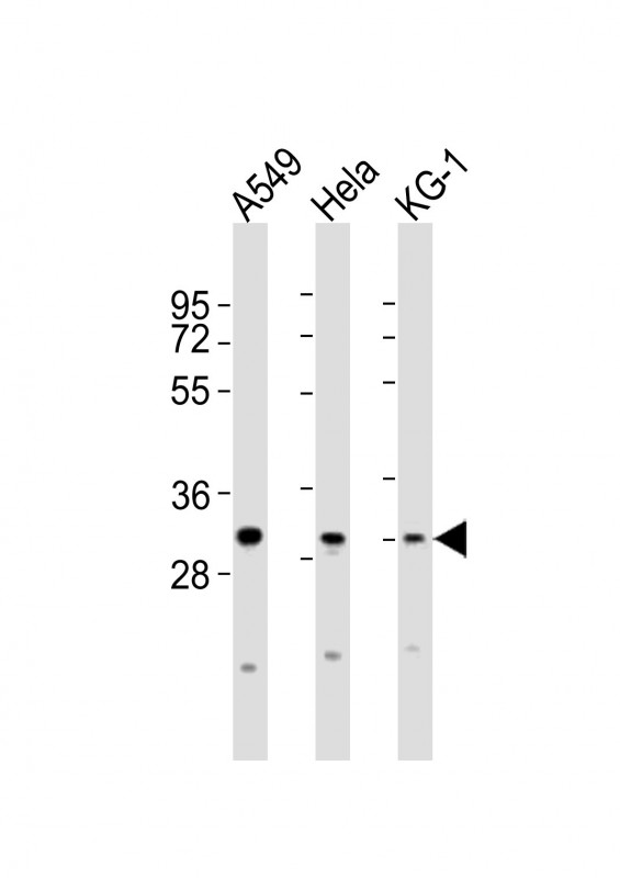 Rabbit anti-PYCRL Polyclonal Antibody(C-term)