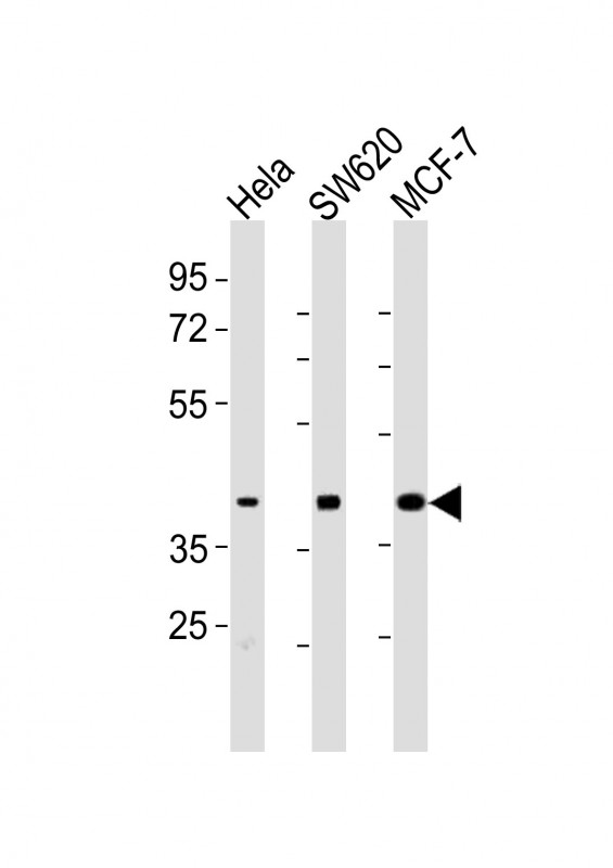 Rabbit anti-HPN Polyclonal Antibody(Center)