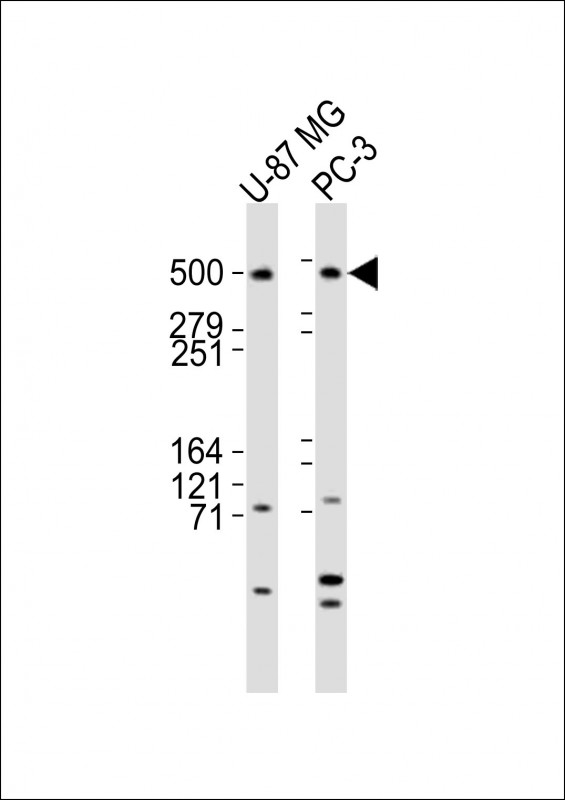 Rabbit anti-DYNC1H1 Polyclonal Antibody(C-term)