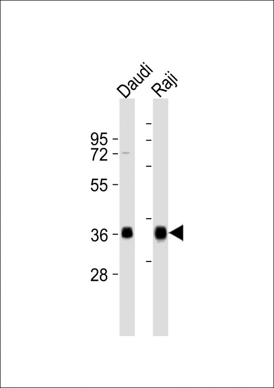 Rabbit anti-HLA-DQA1 Polyclonal Antibody(C-term)