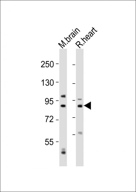 Rabbit anti-CAPN5 Polyclonal Antibody(N-Term)