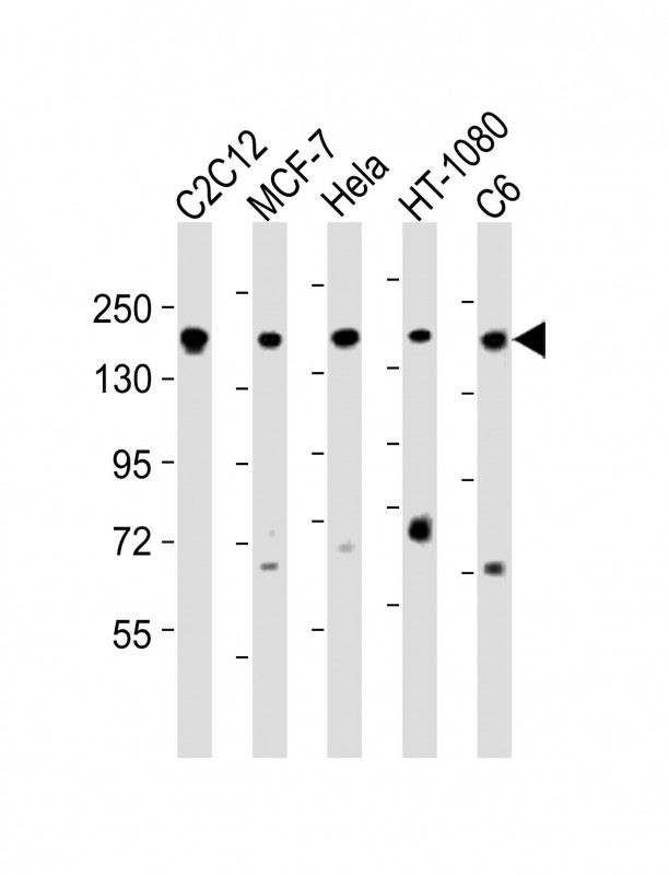 Rabbit anti-ROCK2 Polyclonal Antibody(C-term)