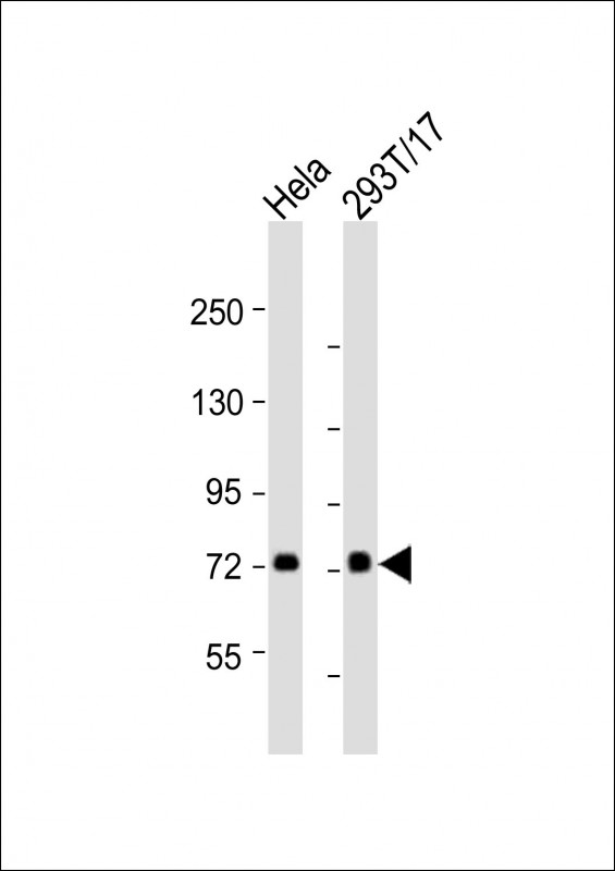 Rabbit anti-CAPN2 Polyclonal Antibody(Center)
