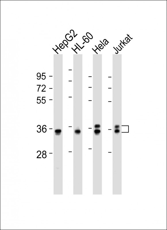 Rabbit anti-AKR7L Polyclonal Antibody(Center)