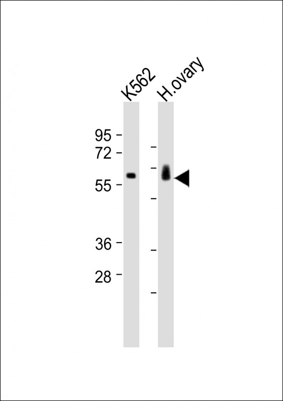 Rabbit anti-C17orf80 Polyclonal Antibody(Center)