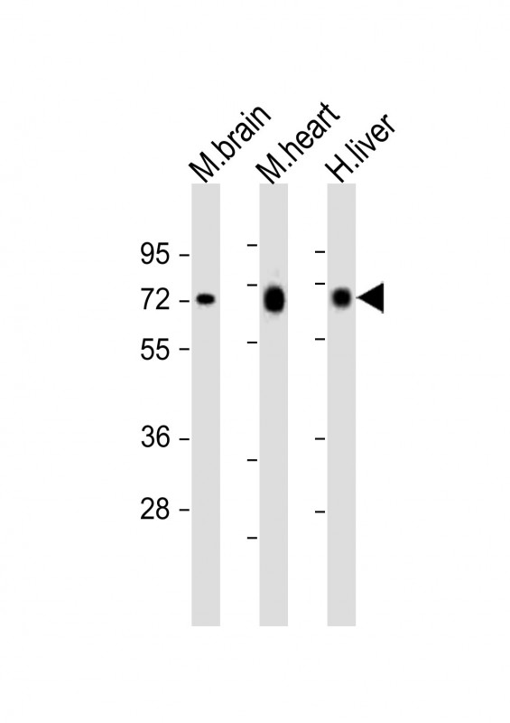Rabbit anti-PGM1 Polyclonal Antibody(C-Term)