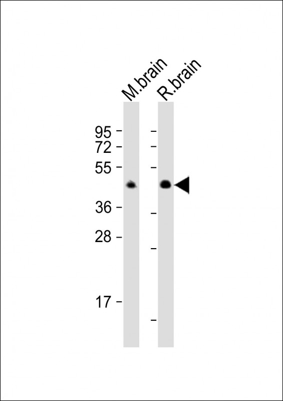 Rabbit anti-CNP Polyclonal Antibody(C-Term)