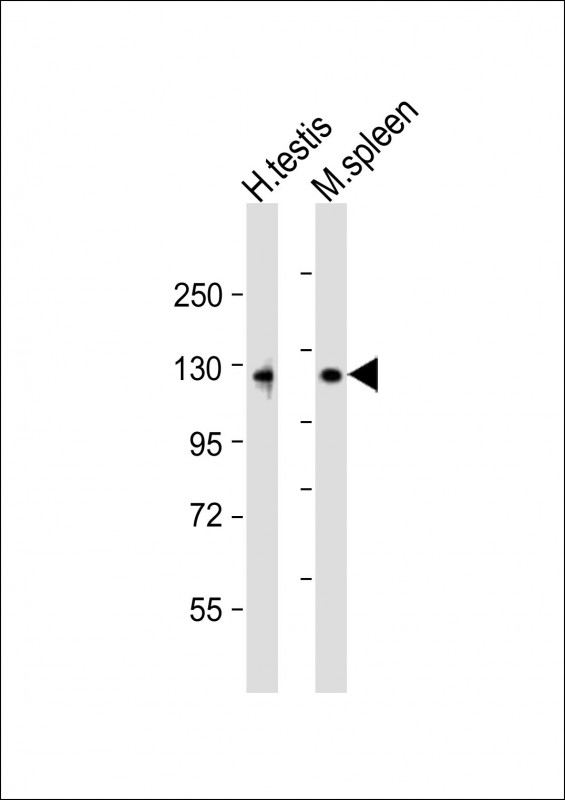Rabbit anti-PPP6R1 Polyclonal Antibody(Center)