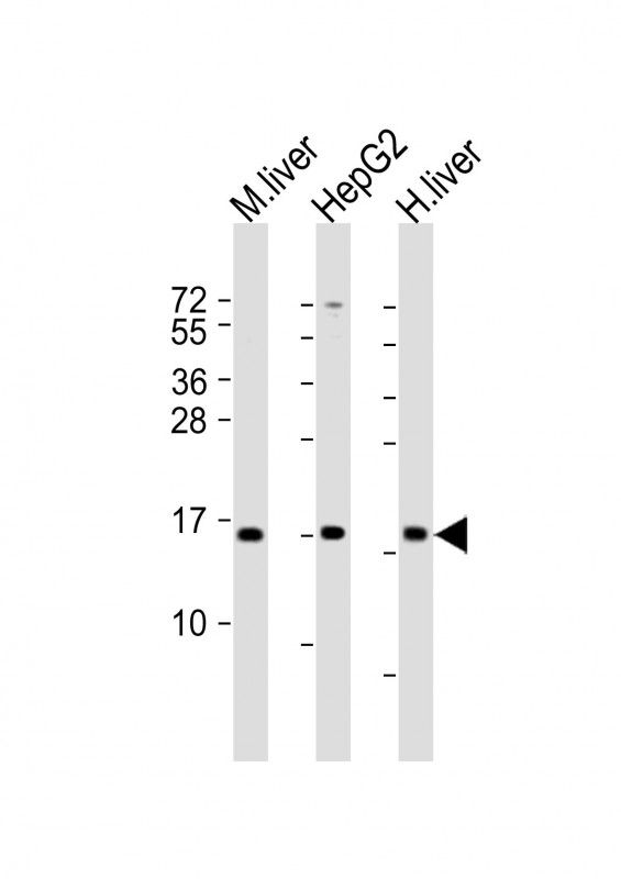 Rabbit anti-CYB5A Polyclonal Antibody(Center)