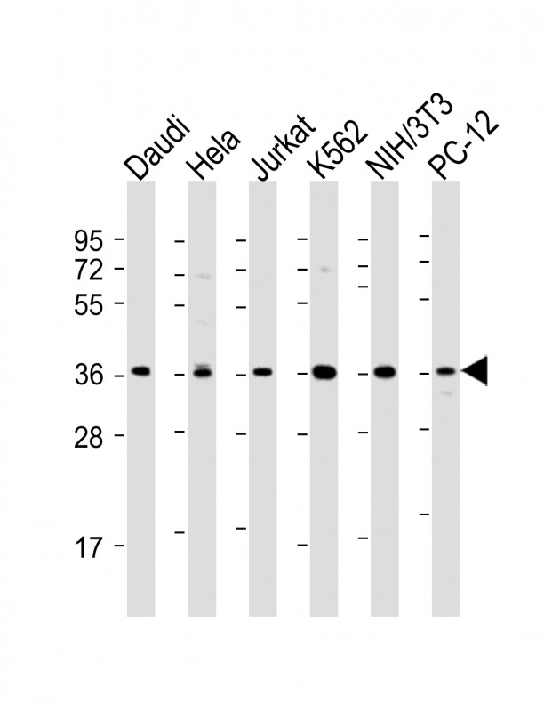 Rabbit anti-IKB α Polyclonal Antibody