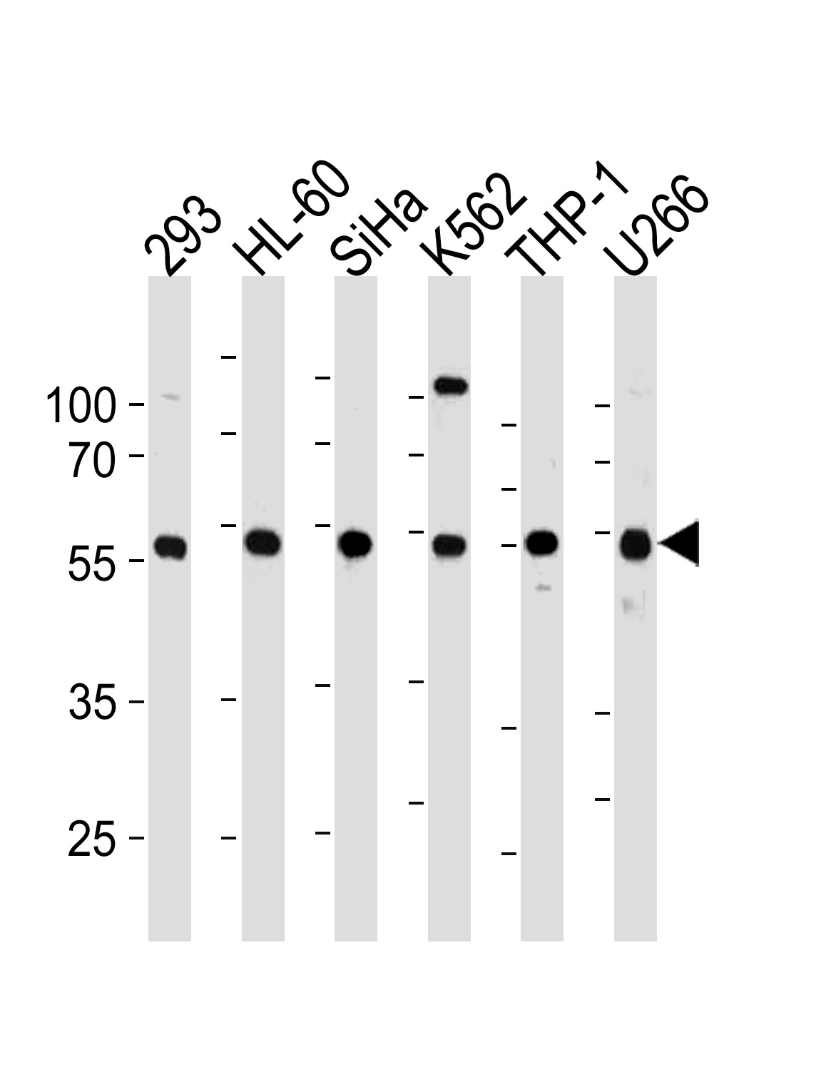 Rabbit anti-YY1 Polyclonal Antibody(N-term)