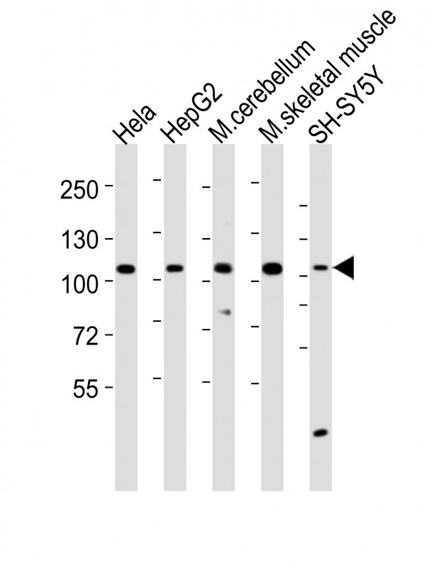 Rabbit anti-LGR5 Polyclonal Antibody(loop2)