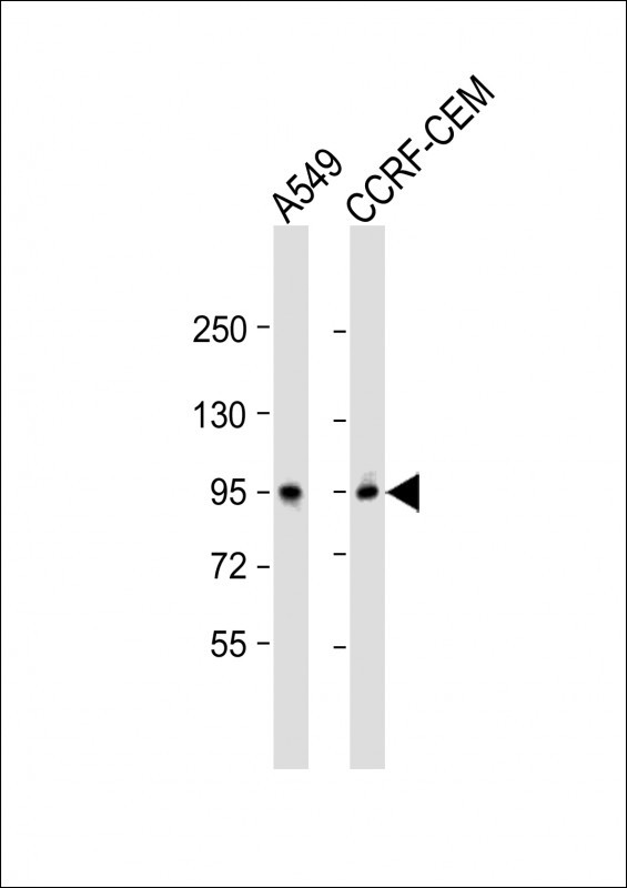 Rabbit anti-CD71 Polyclonal Antibody(C-term)