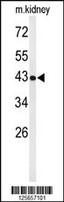 Rabbit anti-UBXN6 Polyclonal Antibody(C-term)
