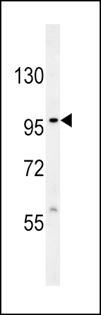Rabbit anti-VLDLR Polyclonal Antibody(Center)