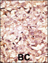 Rabbit anti-ACE2 Polyclonal Antibody(C-term)