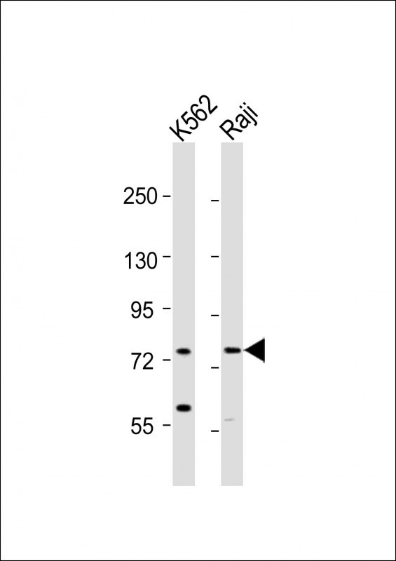 Rabbit anti-ABCB10 Polyclonal Antibody(N-term)