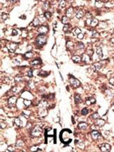 Rabbit anti-MAGEA11 Polyclonal Antibody(N-term)