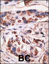 Rabbit anti-MAGEA1 Polyclonal Antibody(Center)