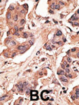 Rabbit anti-MAGEH1 Polyclonal Antibody(C-term)
